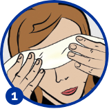 Dry eye disease treatment stage 1
